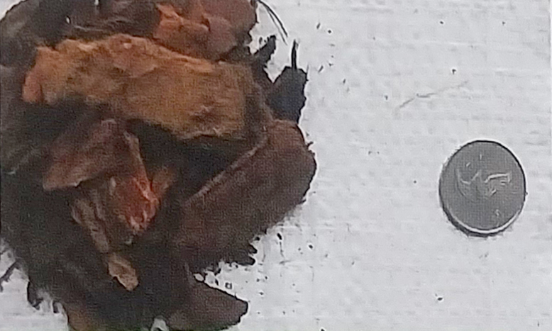 대립(3~4cm)