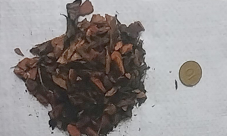 중립(1~2cm)